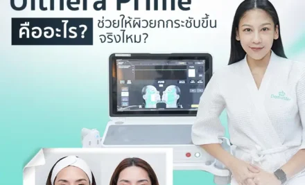 Ulthera Prime คืออะไร ช่วยให้ผิวยกกระชับขึ้นจริงไหม?