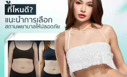ดูดไขมันที่ไหนดี? แนะนำการเลือกสถานพยาบาลให้ปลอดภัย
