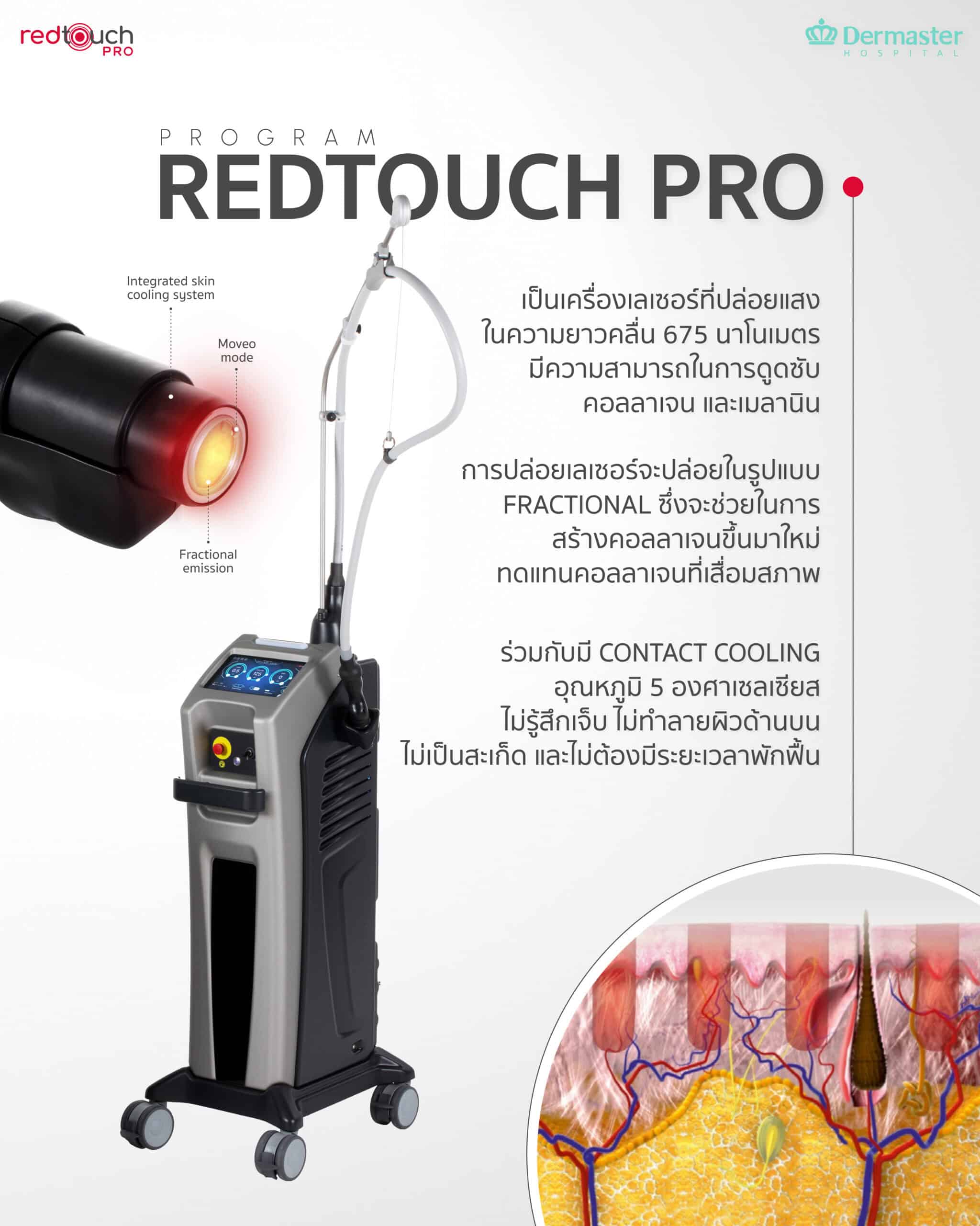 Red Touch Pro ฟื้นฟูผิวใส ลดริ้วรอยไม่ต้องพักฟื้น ไม่ตกสะเก็ด