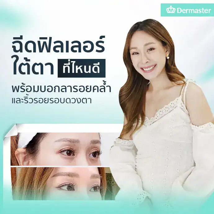 ฉีดฟิลเลอร์ใต้ตาที่ไหนดี? พร้อมบอกลารอยคล้ำและริ้วรอยรอบดวงตา