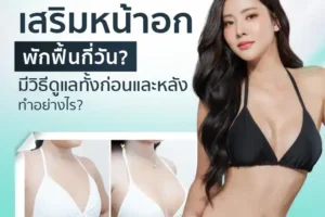 เสริมหน้าอกพักฟื้นกี่วัน มีวิธีดูแลทั้งก่อนและหลังทำอย่างไร?
