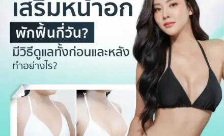 เสริมหน้าอกพักฟื้นกี่วัน มีวิธีดูแลทั้งก่อนและหลังทำอย่างไร?