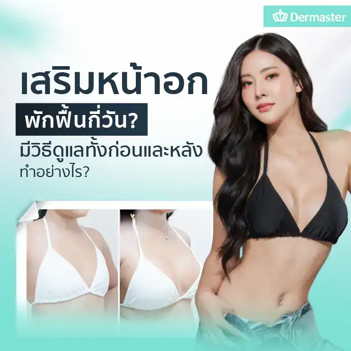 เสริมหน้าอกพักฟื้นกี่วัน มีวิธีดูแลทั้งก่อนและหลังทำอย่างไร?