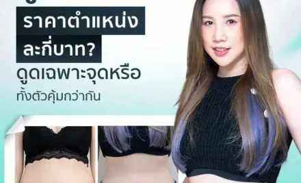 ดูดไขมัน ราคาตำแหน่งละกี่บาท ดูดเฉพาะจุดหรือทั้งตัวคุ้มกว่ากัน?