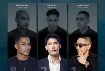 ปลูกผมผู้ชาย เสริมความมั่นใจ พร้อมเทคนิคปลูกผมที่ตอบโจทย์