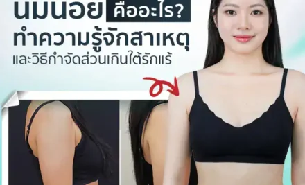 นมน้อยคืออะไร? ทำความรู้จักสาเหตุและวิธีกำจัดส่วนเกินใต้รักแร้