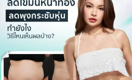 ลดไขมันหน้าท้อง ลดพุงกระชับหุ่น ทำยังไง วิธีไหนเห็นผลบ้าง?