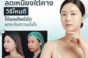 ลดเหนียงใต้คางวิธีไหนดี ให้ผลลัพธ์ชัด ยกระดับความมั่นใจ