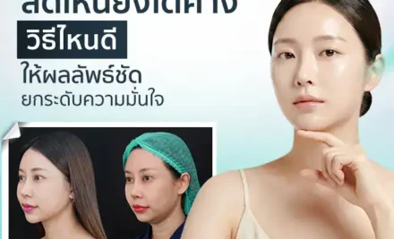 ลดเหนียงใต้คางวิธีไหนดี ให้ผลลัพธ์ชัด ยกระดับความมั่นใจ