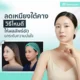 ลดเหนียงใต้คางวิธีไหนดี ให้ผลลัพธ์ชัด ยกระดับความมั่นใจ