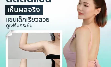 ลดต้นแขนเห็นผลจริง แขนเล็กเรียวสวยดูเฟิร์มกระชับ