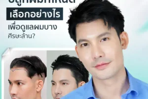 ปลูกผมที่ไหนดี เลือกอย่างไรเพื่อดูแลผมบาง ศีรษะล้าน?