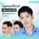 ปลูกผมที่ไหนดี เลือกอย่างไรเพื่อดูแลผมบาง ศีรษะล้าน?