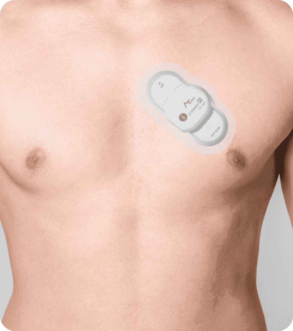 ECG-holter-composite-new-step-v2 ECG-holter-composite-new-step-v2
