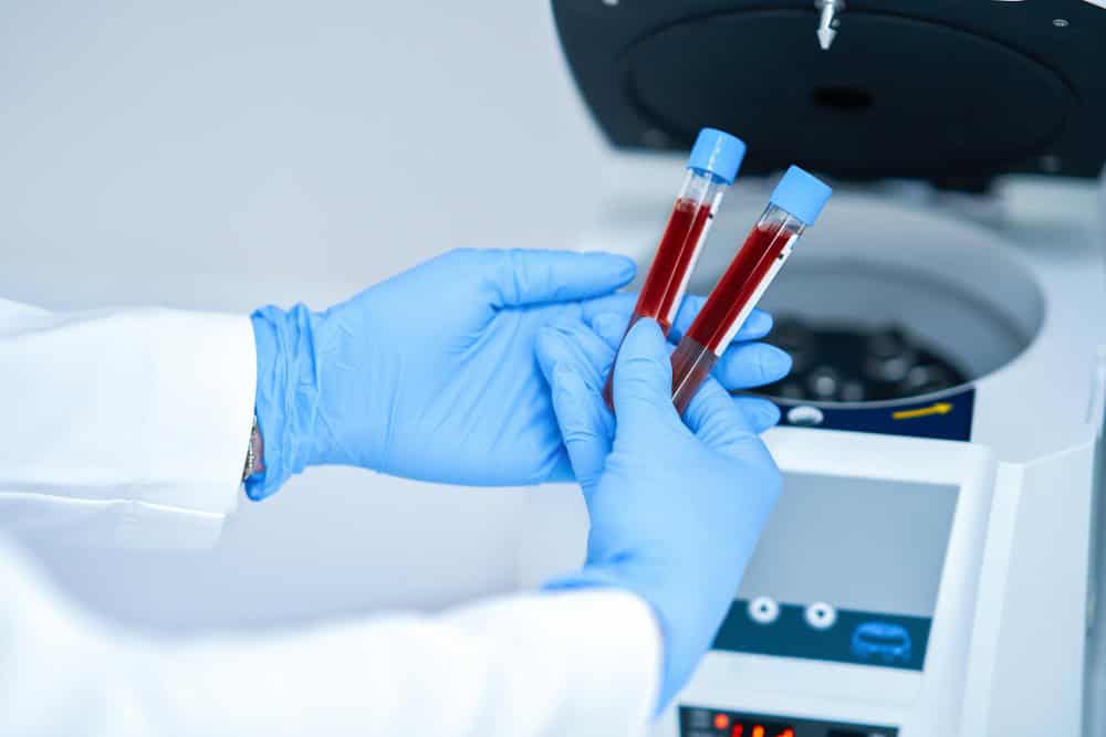 Ematologo zona Policlinico Milano