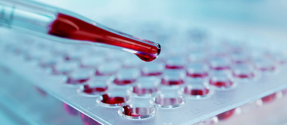 Visita ematologica Milano