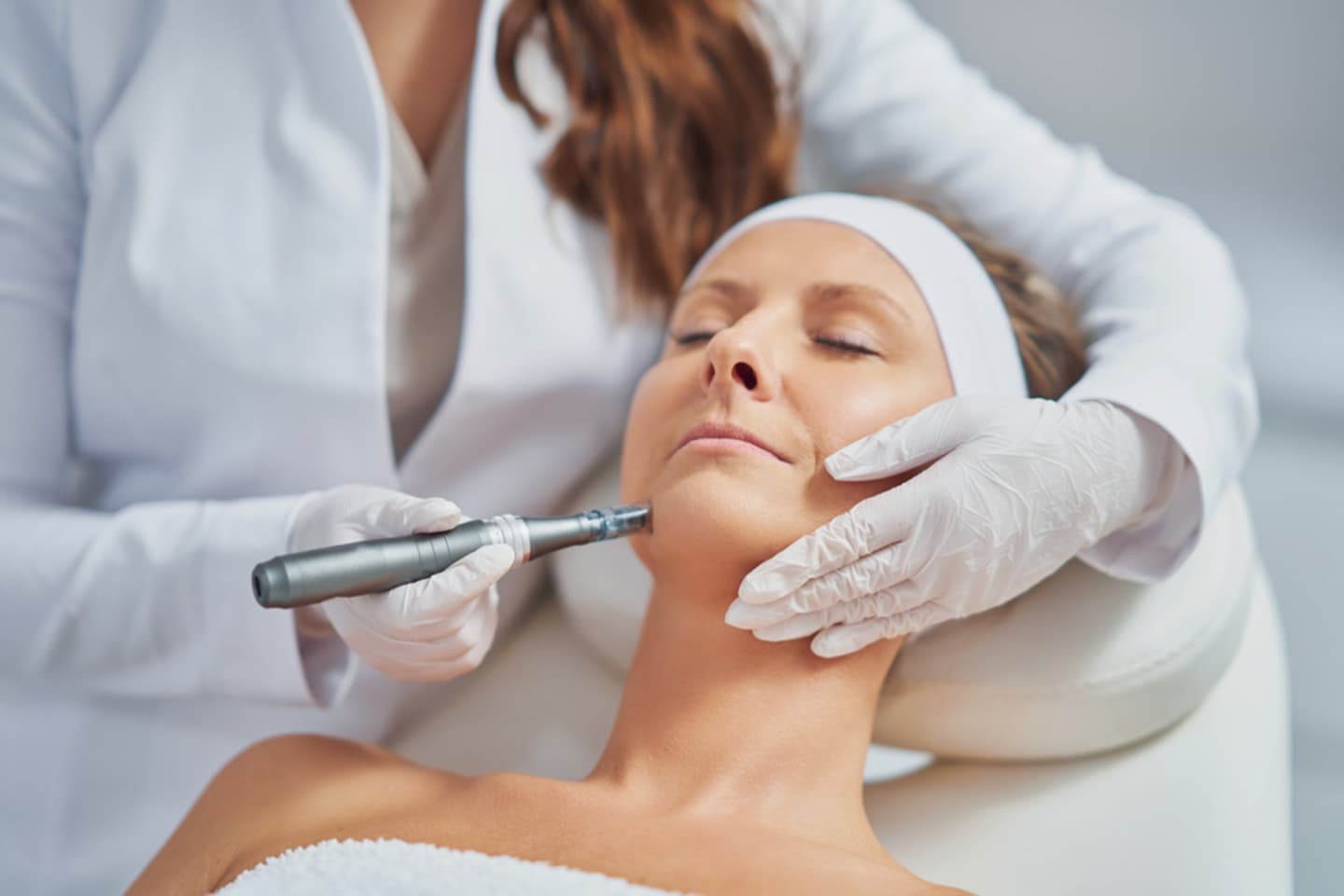 Microneedling a Path to Skin Renewal