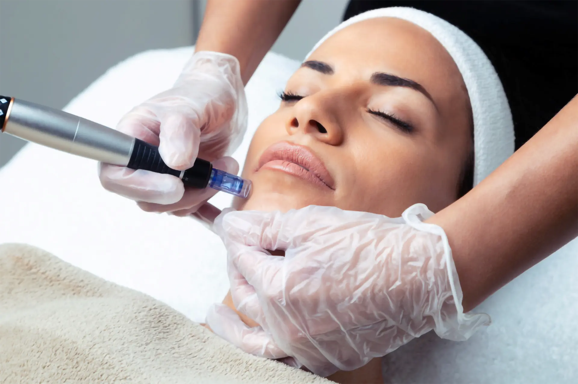microneedling recovery at evolve