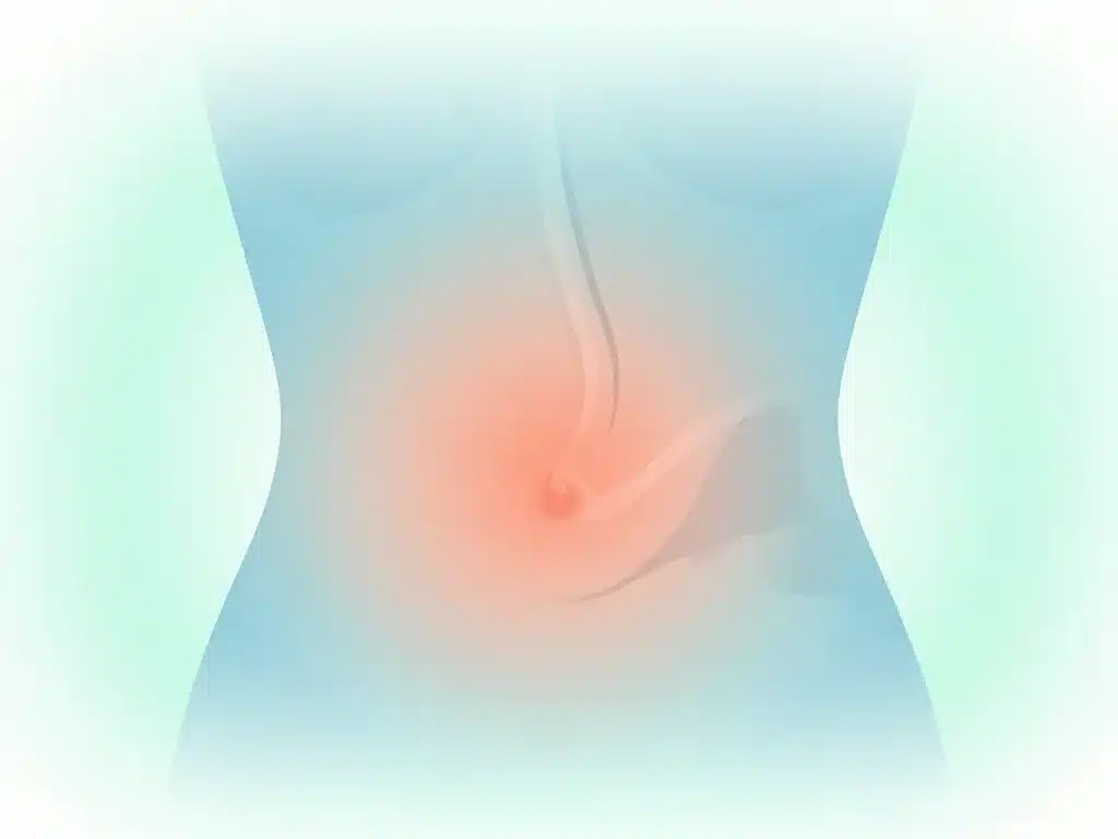 douleur nombril 1 mois après coelioscopie cicatrisation normale