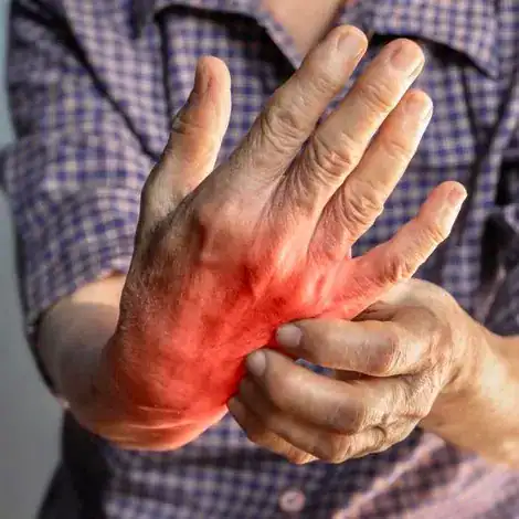 Representación visual de inflamación y dolor articular generalizado