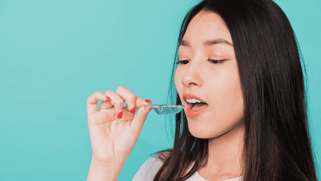 Orthodontic Treatment Options For Adults
