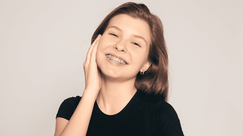 Ceramic braces