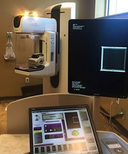mammography-equipment