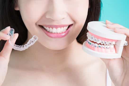 Clear orthodontic retainers and dental braces held by woman showcasing orthodontic dental care.