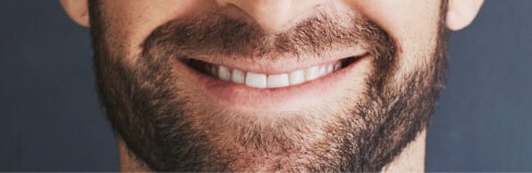 Family Dentist in South Edmonton | Heritage Dental 4 Man With Beard And Straight Teeth Smiling