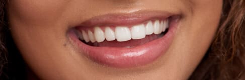 Family Dentist in South Edmonton | Heritage Dental 5 Close Up Of Girl With White And Straight Teeth Smiling