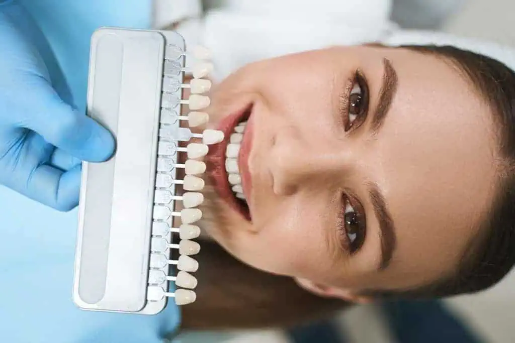 Color-matched dental shade guide used for smile and teeth whitening at Heritage Dental Edmonton.
