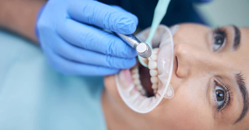 Young woman getting a dental filling from a dentist