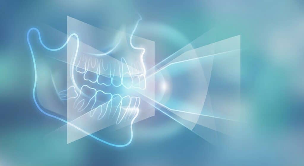 Ray scan highlighting teeth, jawbone, and dental health assessment.