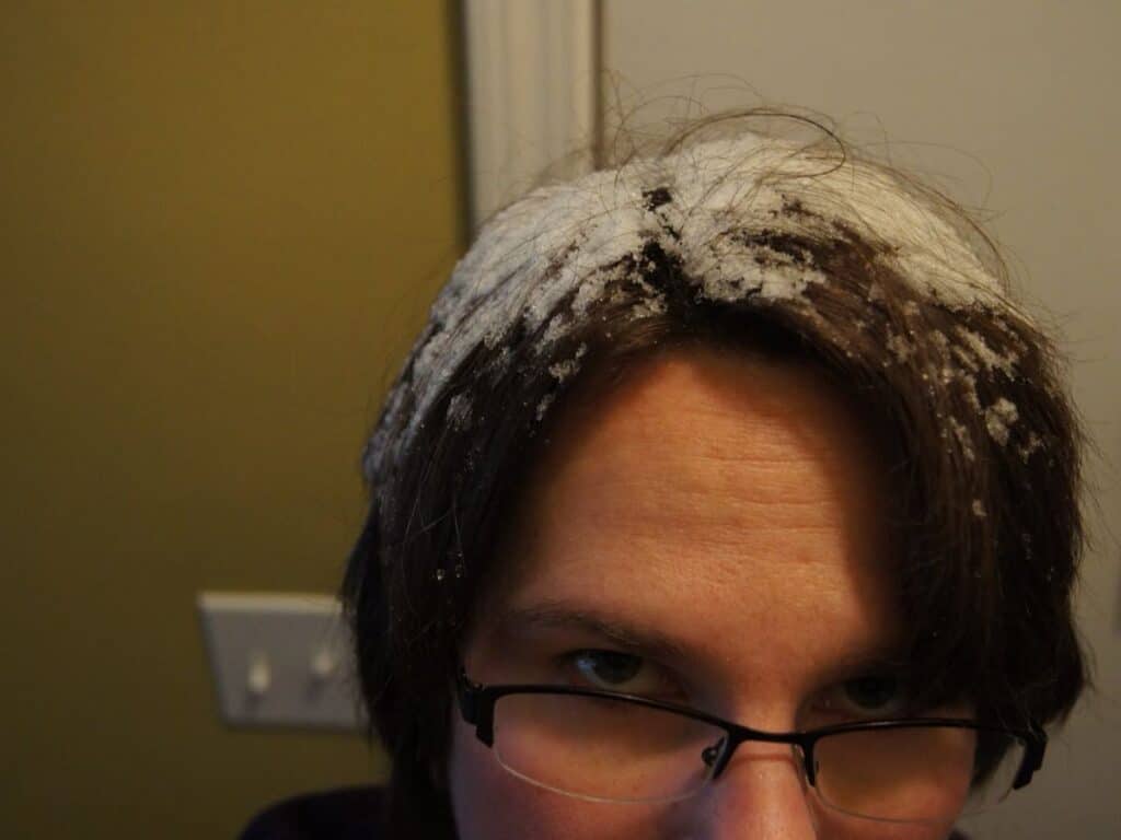 Image shows snow on woman's hair.