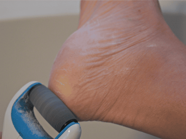 Amope Pedi Perfect in use