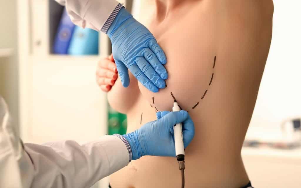 Miglior chirurgo plastico mastoplastica additiva