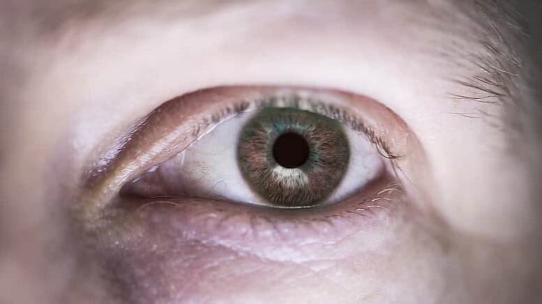 blefaroplastica superiore