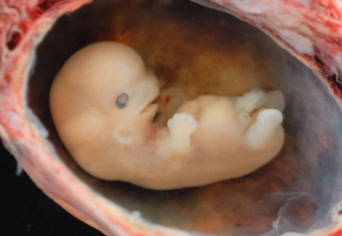 PARANCS JÁNOS VERSÉRŐL