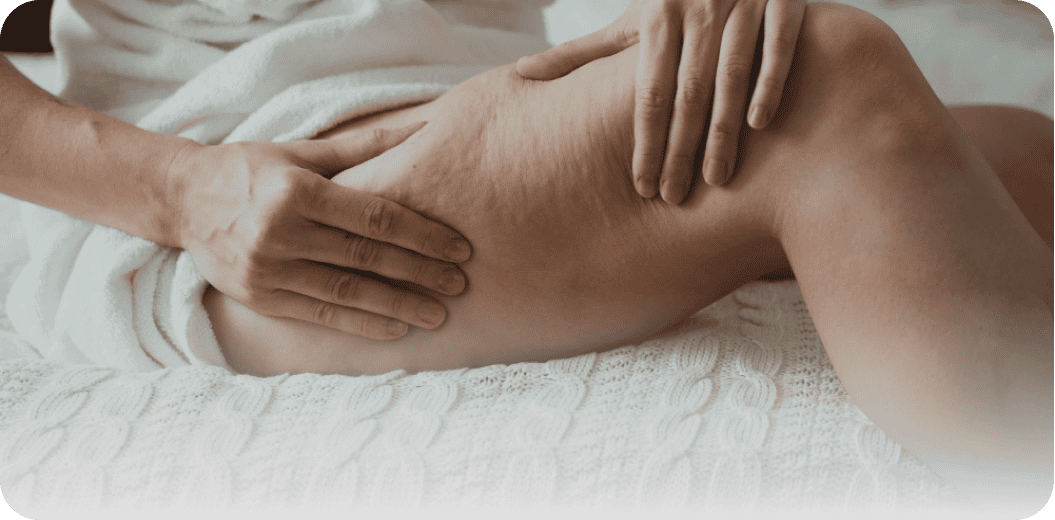 Img-Effetti-cellulite