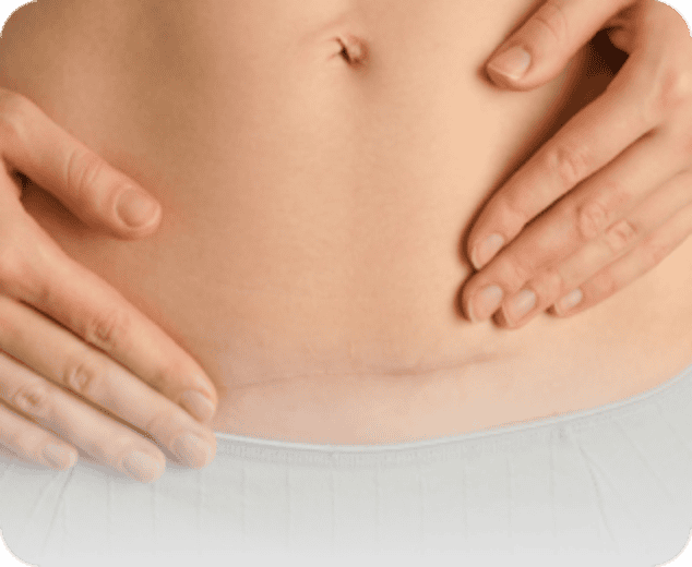 Img-Accelera -Cicatrizzazione