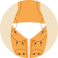 Img-Liposcultura