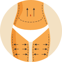 Img-Liposuzione