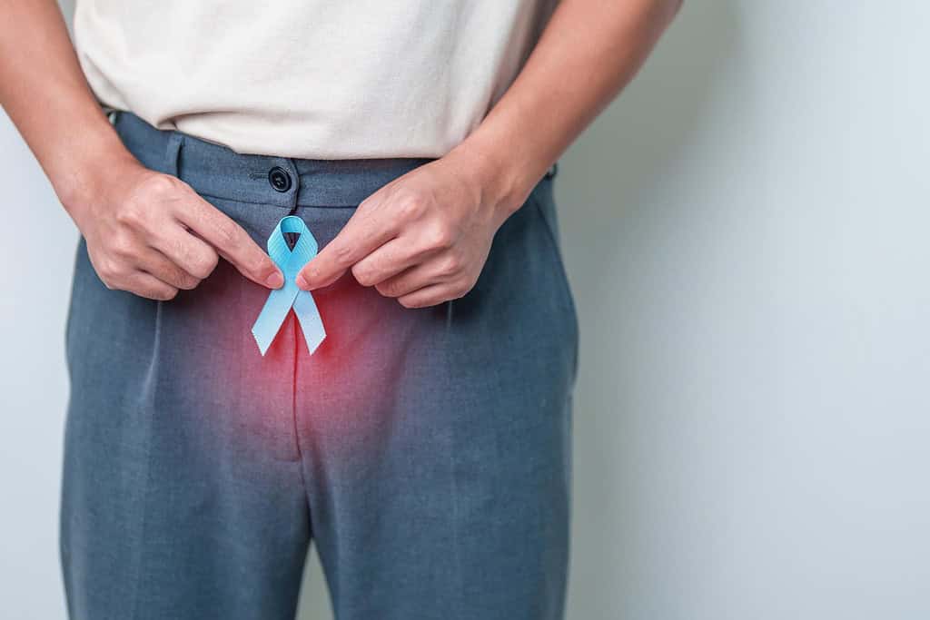 Cistectomia radicale: in cosa consiste