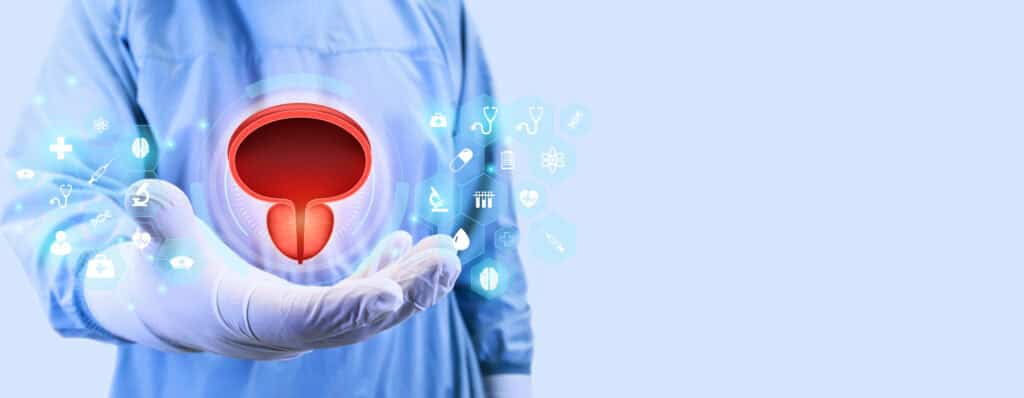 Immunoterapia nel tumore della vescica