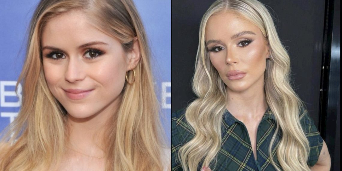 Erin Moriarty Faces Complications After Multiple Facial Surgeries