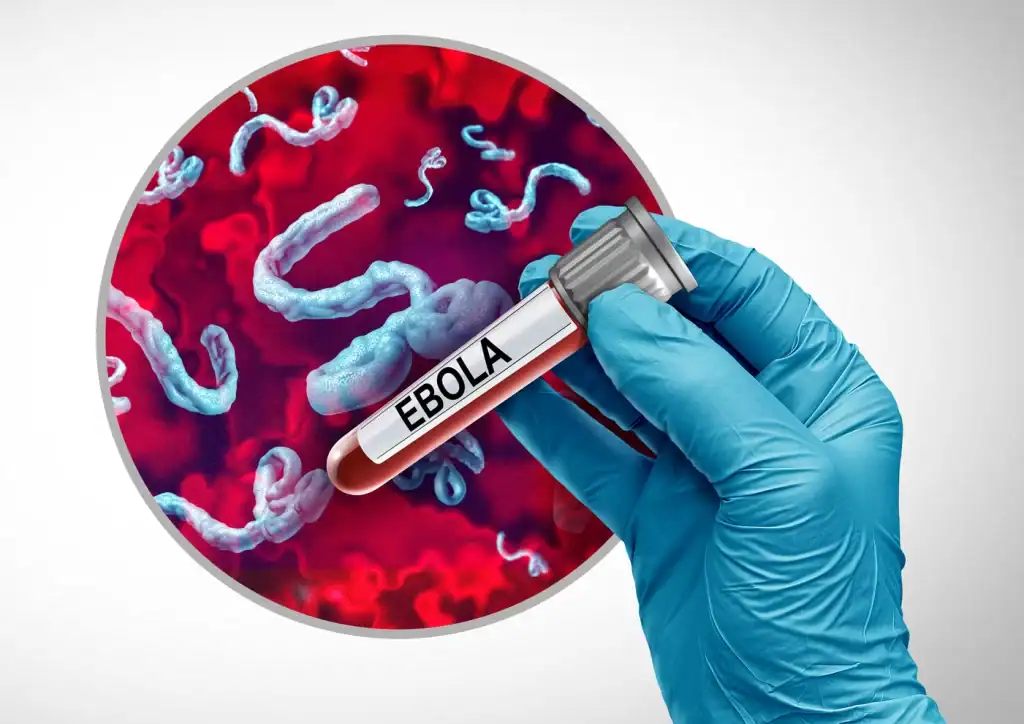 Virusi ya Ebola