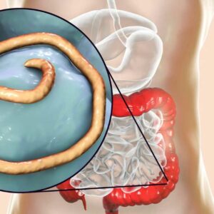 Intestinal Parasites