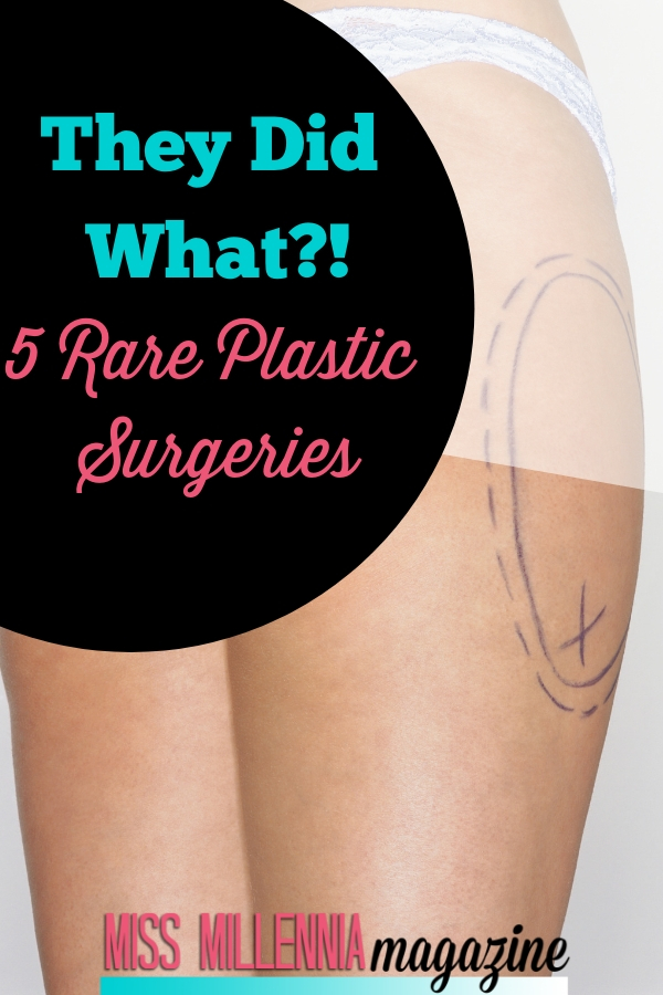5 Rare Plastic Surgeries