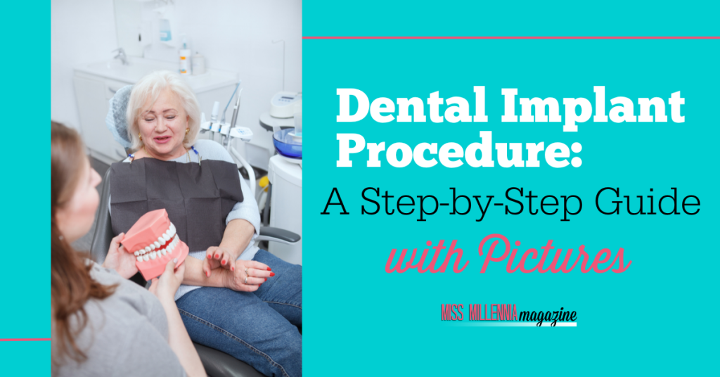 Dental Implant Procedure: A Step-by-Step Guide with Pictures