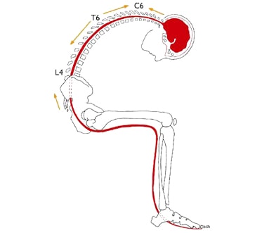 A diagram illustrating pain relief along a red line on a skeleton.